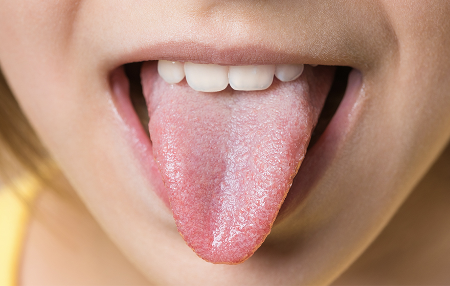 子どもの歯並びが悪くなる理由 舌突出癖（ぜつとつしゅつへき）