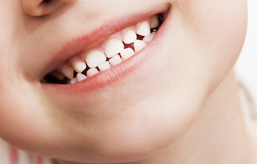 子どもの歯並びが悪くなる理由 歯並びと歯の大きさ、顎の大きさの関係