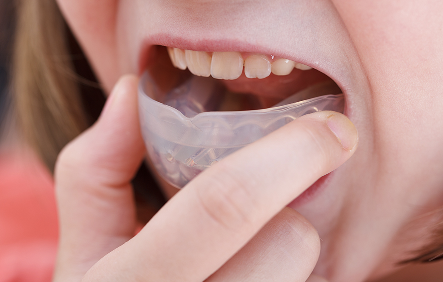お子さまの矯正治療装置について 歯列矯正用咬合誘導装置